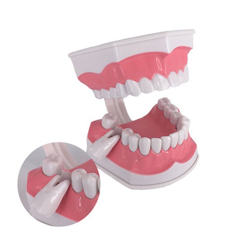 인체 치아 모형(치아 분리형)