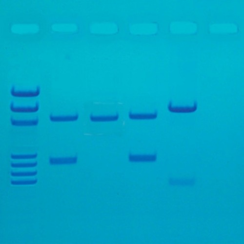 PCR 유전자 지문분석