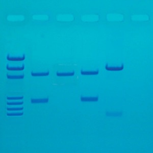PCR 유전자 지문분석